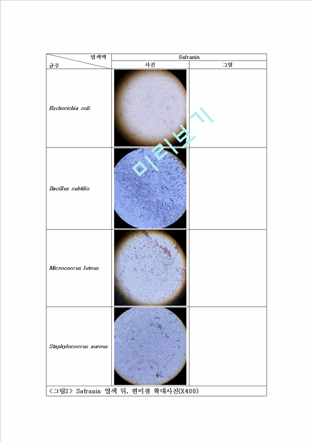 [의학,약학] 미생물학 실험 - Simple staining(단순염색), Gram staining(그람염색) 실험   (6 )